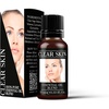 image:imageMystix London  Clear Skin Essential Oil Blend  10ml  Clary sage lavender and tea tree create a fresh floral aroma with clean herbal notes